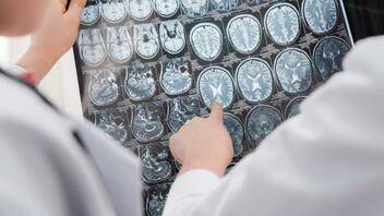 Απρόσμενη ανακάλυψη για τη λειτουργία του εγκεφάλου από Έλληνες επιστήμονες στη Δανία