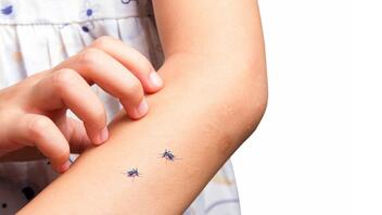 Πέντε φυσικοί τρόποι για να απωθήσετε τα κουνούπια