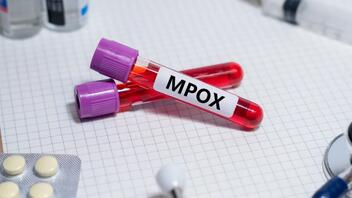 Μpox: Γιατί χρειάζεται ιδιαίτερη προσοχή στα παιδιά 