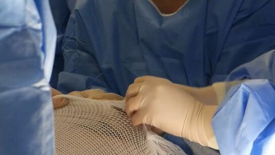 Ισπανία: Μεταμόσχευση τεχνητού δέρματος για σοβαρά εγκαυματίες