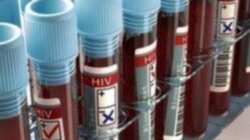 εξεττάσεις για hiv