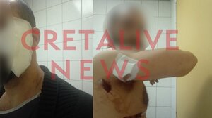 33χρονος τραυματίας στο Cretalive: Ήθελε να μου κάνει ζημιά, ακόμα και να με σκοτώσει