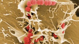 Στρεπτόκοκκος Α: Και τρίτος θάνατος από τις αρχές του χρόνου