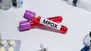 Mpox: Το νέο στέλεχος αλλάζει γρήγορα 