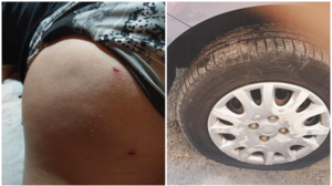 Ανησυχία στο Αρκαλοχώρι για αγέλες αδέσποτων σκυλιών - Δάγκωσαν κοριτσάκι, προκάλεσαν φθορές σε αυτοκίνητο!