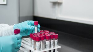 Μελέτη: Απλή αιματολογική εξέταση μπορεί να προβλέψει την καρδιακή προσβολή