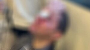 Τι ερευνά η ΕΛΑΣ για τον εντοπισμό των δραστών της επίθεσης στη Νομική