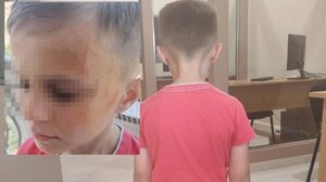 Ξυλοδαρμός 5χρονου σε νηπιαγωγείο: Αύριο η έκτακτη σύσκεψη - Θα εξεταστεί κάθε πτυχή της υπόθεσης