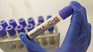Ηπατίτιδα Α: Σημαντική αύξηση κρουσμάτων σε 4 ευρωπαϊκές χώρες - Η θέση της Ελλάδας