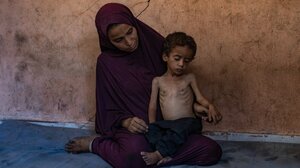 Γιατροί Χωρίς Σύνορα: Πάνω από 600 παιδιά πέθαναν από υποσιτισμό τους τελευταίους 6 μήνες στη Νιγηρία