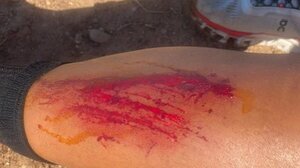 Ηρωική προσπάθεια: Τραυματισμός ναυαγοσώστη σε περιστατικό διπλού πνιγμού