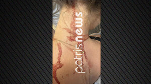 Την κυνηγούσε με ψαλίδι στους δρόμους της Αμαλιάδας και την κάρφωσε στην πλάτη