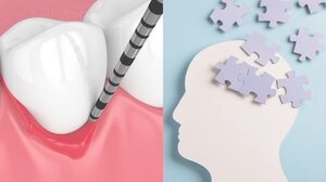 Στοματική Υγεία και Νόσος Alzheimer: Μια αθέατη σύνδεση