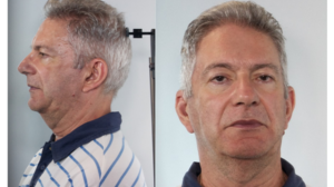 Χανιά: Αυτός είναι ο γιατρός που κατηγορείται για ασέλγεια σε παιδική κατασκήνωση