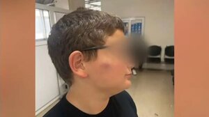 Θεσσαλονίκη: «Δεν θα στείλω ακόμα τον γιο μου στο σχολείο» λέει η μητέρα του 11χρονου που ξυλοκοπήθηκε από συμμαθητές του