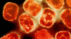 Ευλογιά των πιθήκων: Καταγράφηκε στην Ελλάδα το πρώτο κρούσμα