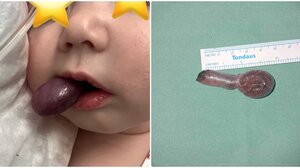 ΠαΓΝΗ: το σπάνιο περιστατικό με το μόλις 3 μηνών μωράκι και το «θαύμα» των εορτών 