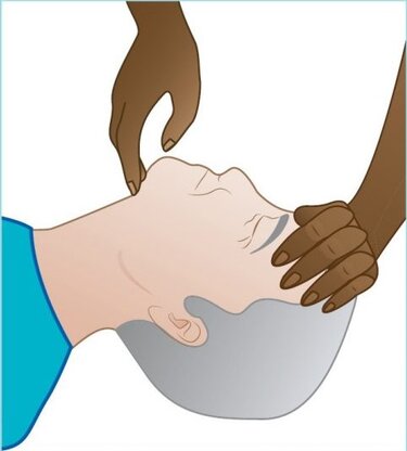 Απόφραξη Αεραγωγού