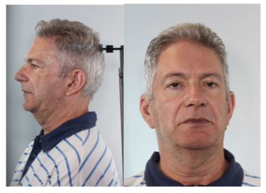 Τσουβαλάκης Ασέλγεια, Χανια