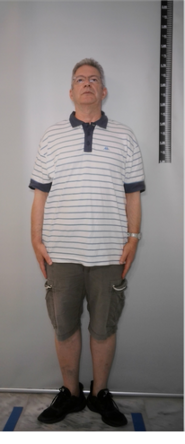 Ασέλγεια Γιατρός Χανιά