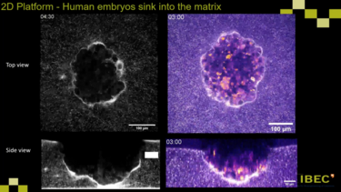 Επιστήμονες κατέγραψαν για πρώτη φορά σε βίντεο την εμφύτευση ανθρώπινου εμβρύου στη μήτρα