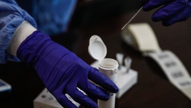 Τζανάκης για κορωνοϊό: Είναι νωρίς να μιλάμε για ενδημική νόσο