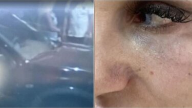 Θέμης Αδαμαντίδης: Βίντεο-ντοκουμέντο από τη στιγμή που η σύντροφός του πέφτει θύμα βιαιοπραγίας