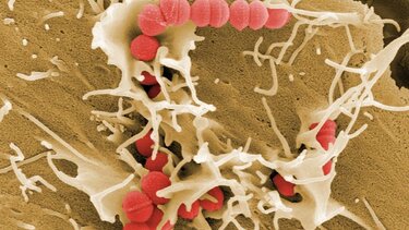 Στρεπτόκοκκος Α: Και τρίτος θάνατος από τις αρχές του χρόνου