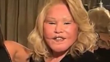 Jocelyn Wildenstein