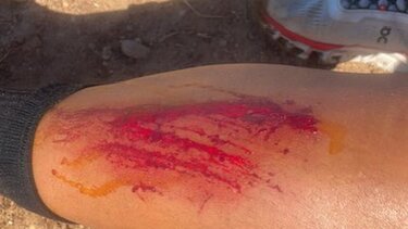 okeanis traymatismos