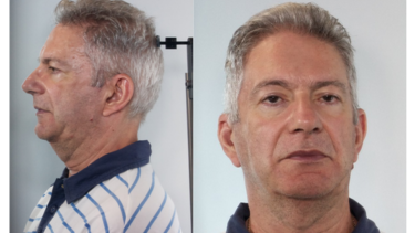 Τσουβαλάκης Ασέλγεια, Χανια